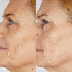 Caudalie Die Reichhaltige Nachfullpackung Богатый пополнение пакета