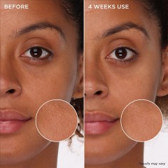 Benefit Tight #x27;n Toned Poren verfeinernder Schaum-Toner mit AHA+PHA  Tight #x27;n Toned Тоник-пенка для сужения пор с AHA+PHA