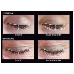 Chiara Ambra Lash Serum  Сыворотка для ресниц